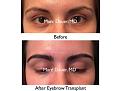 Click image for larger version

Name:	Hair Transplant Slides copy55.001.jpg
Views:	317
Size:	13.3 KB
ID:	478272