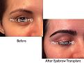 Click image for larger version

Name:	Hair Transplant Slides copy55.002.jpg
Views:	354
Size:	13.3 KB
ID:	478273