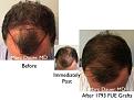 Click image for larger version

Name:	Hair Transplant Slides copy52.004.jpg
Views:	301
Size:	15.6 KB
ID:	478310