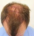 Click image for larger version

Name:	pre-op (6).jpg
Views:	435
Size:	40.4 KB
ID:	478341