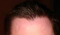 Click image for larger version

Name:	hair1.jpg
Views:	249
Size:	71.4 KB
ID:	478345
