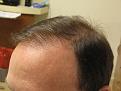 Click image for larger version

Name:	Left-before.jpg
Views:	327
Size:	94.4 KB
ID:	478399