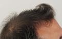 Click image for larger version

Name:	ja before R profile.jpg
Views:	271
Size:	87.5 KB
ID:	478451