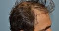 Click image for larger version

Name:	DSC_5100.jpg
Views:	403
Size:	97.0 KB
ID:	478524