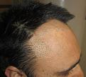 Click image for larger version

Name:	IMG_4132.jpg
Views:	441
Size:	92.4 KB
ID:	478618
