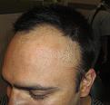 Click image for larger version

Name:	IMG_4130.jpg
Views:	420
Size:	92.3 KB
ID:	478619