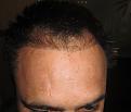 Click image for larger version

Name:	IMG_4122.jpg
Views:	427
Size:	91.9 KB
ID:	478620