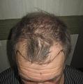 Click image for larger version

Name:	IMG_5913.jpg
Views:	419
Size:	91.3 KB
ID:	478638