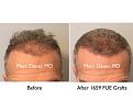 Click image for larger version

Name:	Hair Transplant Slides copy13.001.jpg
Views:	431
Size:	12.9 KB
ID:	478765