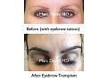Click image for larger version

Name:	Hair Transplant Slides copy95.001.jpg
Views:	336
Size:	12.9 KB
ID:	478769