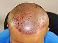 Click image for larger version

Name:	gr imm post chin down.jpg
Views:	422
Size:	94.8 KB
ID:	478788