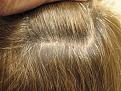Click image for larger version

Name:	40361 Scar view 6 months after.jpg
Views:	299
Size:	97.5 KB
ID:	478818