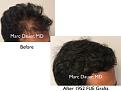 Click image for larger version

Name:	Hair Transplant Slides copy88.001.jpg
Views:	339
Size:	12.9 KB
ID:	478821