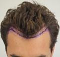 Click image for larger version

Name:	pre-op (6).JPG
Views:	367
Size:	24.9 KB
ID:	478837