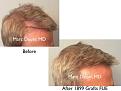 Click image for larger version

Name:	Hair Transplant Slides copy86.001.jpg
Views:	314
Size:	13.1 KB
ID:	478862