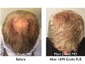 Click image for larger version

Name:	Hair Transplant Slides copy86.003.jpg
Views:	373
Size:	17.8 KB
ID:	478864