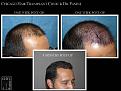 Click image for larger version

Name:	Slide3.JPG
Views:	586
Size:	74.1 KB
ID:	478869