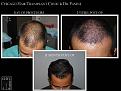 Click image for larger version

Name:	Slide5.JPG
Views:	563
Size:	67.1 KB
ID:	478871