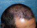 Click image for larger version

Name:	Slide10.jpg
Views:	566
Size:	95.2 KB
ID:	478875