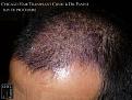 Click image for larger version

Name:	Slide11.jpg
Views:	553
Size:	95.7 KB
ID:	478877