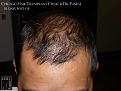 Click image for larger version

Name:	Slide13.JPG
Views:	550
Size:	78.9 KB
ID:	478879