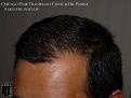 Click image for larger version

Name:	Slide16.JPG
Views:	568
Size:	68.1 KB
ID:	478882