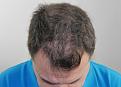 Click image for larger version

Name:	mc 1 year post chin down.jpg
Views:	330
Size:	91.3 KB
ID:	479021