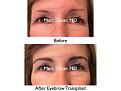 Click image for larger version

Name:	Hair Transplant Slides copy111.002.jpg
Views:	310
Size:	13.0 KB
ID:	479161