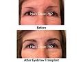 Click image for larger version

Name:	Hair Transplant Slides copy111.002.jpg
Views:	235
Size:	13.0 KB
ID:	479161