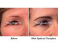 Click image for larger version

Name:	Hair Transplant Slides copy111.001.jpg
Views:	314
Size:	13.8 KB
ID:	479162