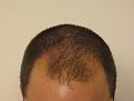 Click image for larger version

Name:	Front before.jpg
Views:	471
Size:	92.9 KB
ID:	479252