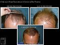 Click image for larger version

Name:	Slide2.JPG
Views:	394
Size:	72.8 KB
ID:	479333