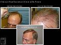 Click image for larger version

Name:	Slide3.JPG
Views:	353
Size:	71.0 KB
ID:	479334