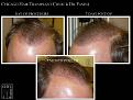 Click image for larger version

Name:	Slide6.JPG
Views:	360
Size:	78.0 KB
ID:	479337