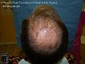 Click image for larger version

Name:	Slide11.JPG
Views:	394
Size:	71.4 KB
ID:	479342