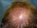 Click image for larger version

Name:	Slide15.jpg
Views:	382
Size:	95.4 KB
ID:	479346