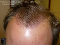 Click image for larger version

Name:	Slide17.JPG
Views:	376
Size:	86.0 KB
ID:	479348