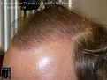 Click image for larger version

Name:	Slide19.JPG
Views:	390
Size:	95.2 KB
ID:	479350