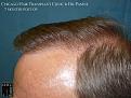 Click image for larger version

Name:	Slide24.JPG
Views:	366
Size:	91.1 KB
ID:	479355