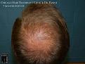 Click image for larger version

Name:	Slide27.JPG
Views:	355
Size:	75.7 KB
ID:	479358