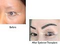 Click image for larger version

Name:	Hair Transplant Slides copy161.002.jpg
Views:	317
Size:	10.6 KB
ID:	479383