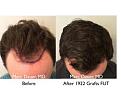 Click image for larger version

Name:	Hair Transplant Slides copy229.004.jpg
Views:	449
Size:	14.9 KB
ID:	479461