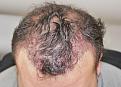 Click image for larger version

Name:	ja imm post chin down.jpg
Views:	277
Size:	94.9 KB
ID:	479552