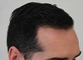 Click image for larger version

Name:	IMG_0635.jpg
Views:	269
Size:	79.1 KB
ID:	479638
