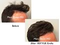 Click image for larger version

Name:	Hair Transplant Slides copy229.006.jpg
Views:	346
Size:	12.2 KB
ID:	479645