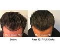 Click image for larger version

Name:	Hair Transplant Slides copy811.006.jpg
Views:	286
Size:	15.4 KB
ID:	479689