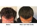Click image for larger version

Name:	Hair Transplant Slides copy811.006.jpg
Views:	358
Size:	15.4 KB
ID:	479689