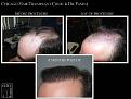 Click image for larger version

Name:	Slide4.JPG
Views:	570
Size:	69.3 KB
ID:	479745