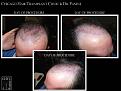 Click image for larger version

Name:	Slide7.JPG
Views:	615
Size:	68.2 KB
ID:	479748