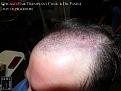 Click image for larger version

Name:	Slide14.JPG
Views:	596
Size:	79.5 KB
ID:	479755